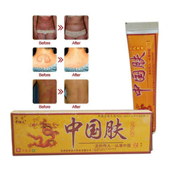 15g Natural Chinese Medicine Herbal Anti Bacteria Cream Psoriasis Eczema Ointment Skin Problem Repair Treatment Health Care