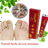 Chinese Medicine Plaster Nail Fungus Treatment Cream Onychomycosis Anti Fungal Nail Infection Fights Bacteria Naturally ointment