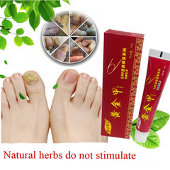 Chinese Medicine Plaster Nail Fungus Treatment Cream Onychomycosis Anti Fungal Nail Infection Fights Bacteria Naturally ointment