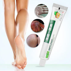 Powerful Chinese Medicinal Ointment Hand Foot Crack Cream Heel Chapped Peeling Repair Frostbite Anti Dry Crack Skin Creams