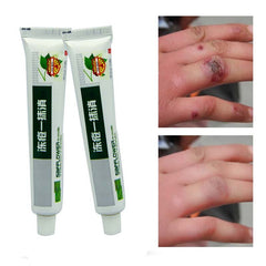 Chinese Medicinal Ointment Hand Foot Crack Cream Heel Chapped Peeling Repair Frostbite Anti Dry Crack Skin Creams Wholesale
