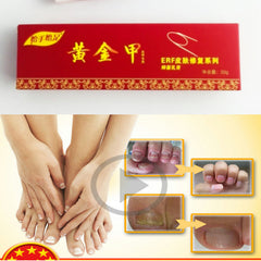 Chinese Medicine Plaster Nail Fungus Treatment Cream Onychomycosis Anti Fungal Nail Infection Fights Bacteria Naturally ointment