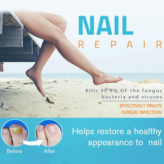 Nail Fungal Treatment Pen Antibacterial film Anti Fungus Infection Biological Repair Solution Nutritious Oil Nail Repair Pencil