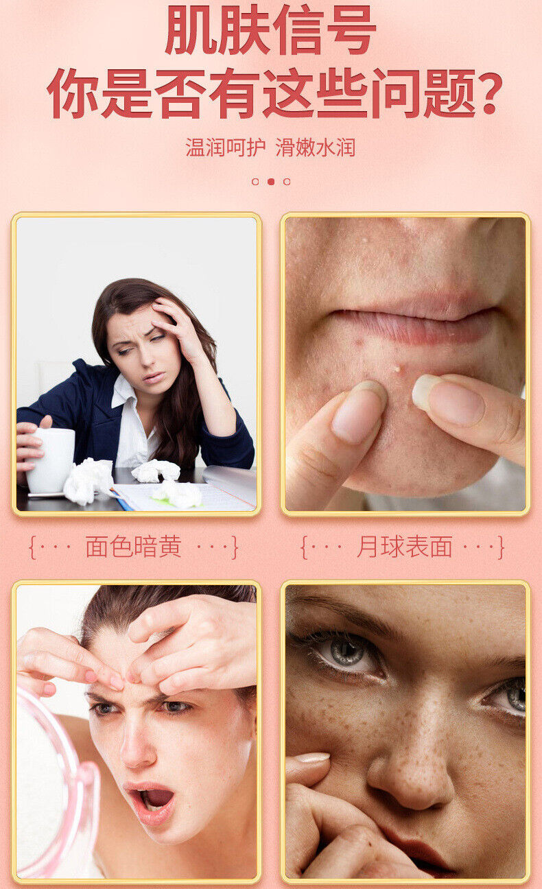 HelloYoung 10g*25packs/bag Mulberry Rose Prickly Pear Tea Wellness Tea Goddess Tea