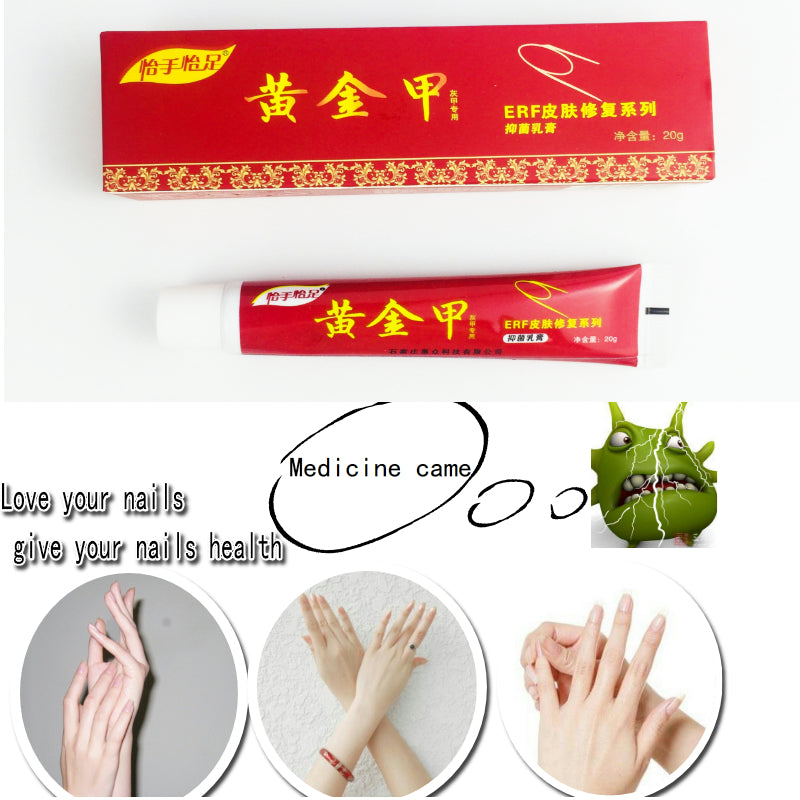 Chinese Medicine Plaster Nail Fungus Treatment Cream Onychomycosis Anti Fungal Nail Infection Fights Bacteria Naturally ointment