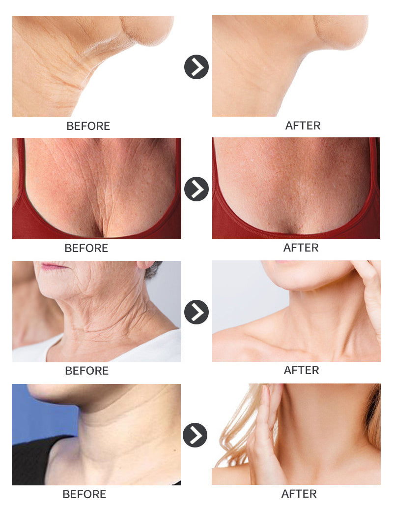 Xhekpon Crema Face Neck Cream 40ml Neckline Cream Wrinkle Smooth Anti Aging Whitening Cream Moisturizing Nourishing Neck Care