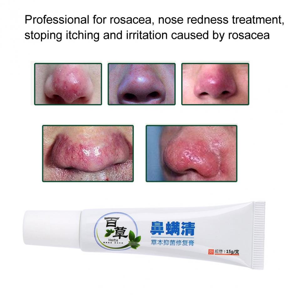 Nose Massage Tools Rosacea Treatment Cream Nose Redness Removal Cleaning Antibacterial Gel Skin Care Product